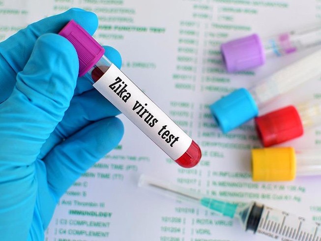 Phát hiện 32 người nhiễm virus Zika
