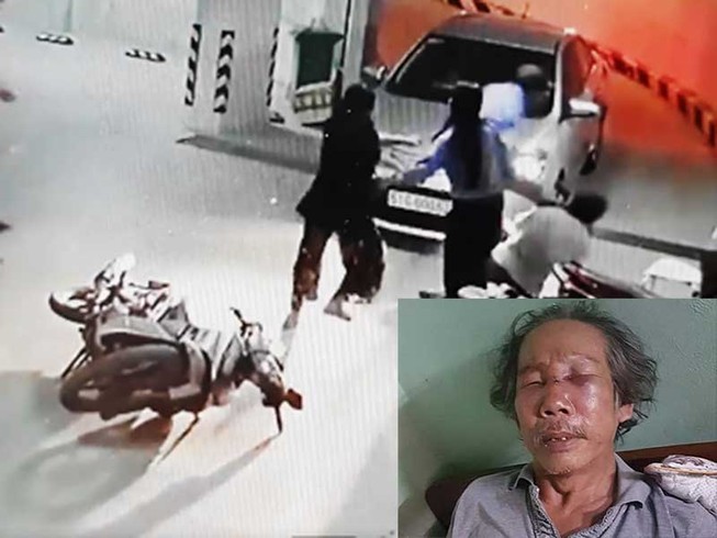 Điều tra bảo vệ chung cư đánh người nhập viện