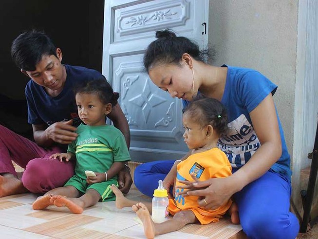 Cuộc sống mới của 2 bé dính nhau vùng cụt