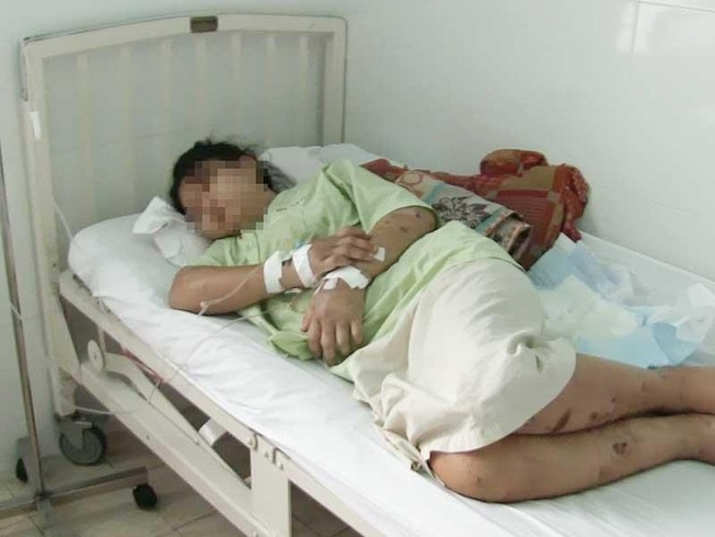 Lời kể của cô gái bị tra tấn dã man ở Bình Chánh