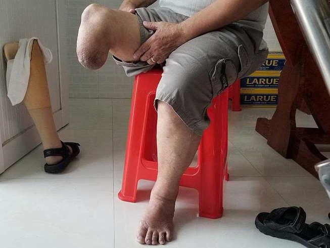 Cục Người có công trả lời về việc giám định lại vết thương