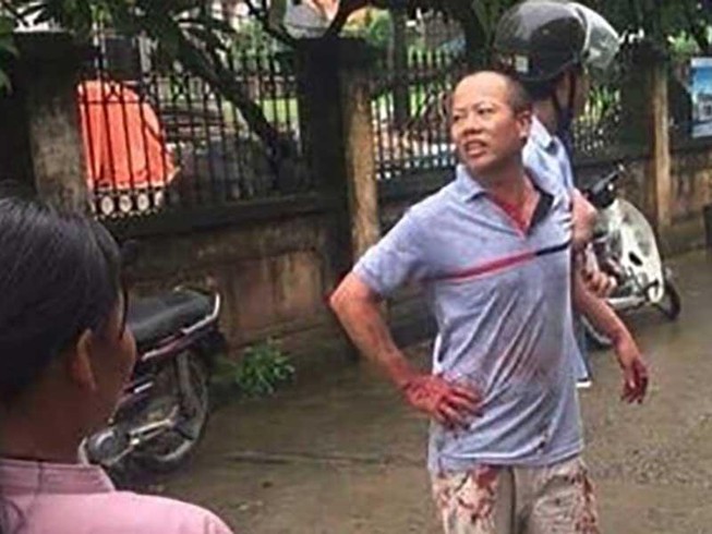 Sau truy sát gia đình em trai, nghi can tự tử bất thành