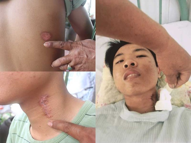 Nam thanh niên tố bị CSGT bắn gây thương tích