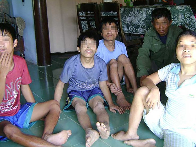 11 Sở Y tế phải giải trình hồ sơ nhiễm chất độc hóa học giả
