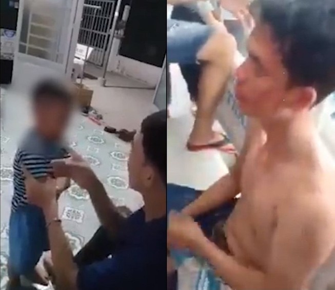 Công an nói về vụ người cha tát con tím mặt và bị đánh