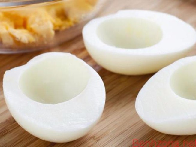Tử vong chỉ vì ăn kiêng quá ngặt nghèo