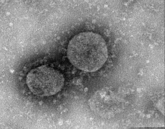 Hong Kong nói về thời gian hoàn thiện vaccine ngừa corona