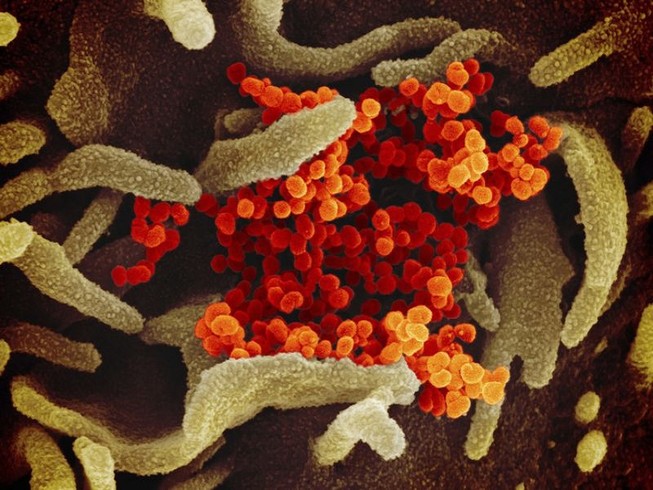 Hình ảnh kính hiển vi điện tử cho thấy virus SARS-CoV-2 (màu cam) màu cam, nổi lên từ bề mặt tế bào. Ảnh: AP