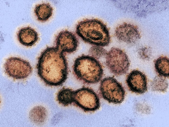 Ảnh chụp virus gây dịch COVID-19 dưới kính hiển vi. Ảnh: GETTY