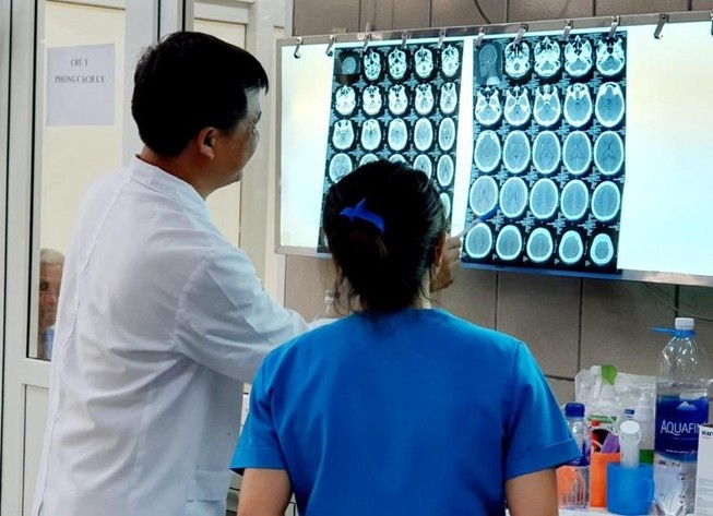 Ca đầu tiên ở Việt Nam bị xuất huyết não khi dùng ma túy đá