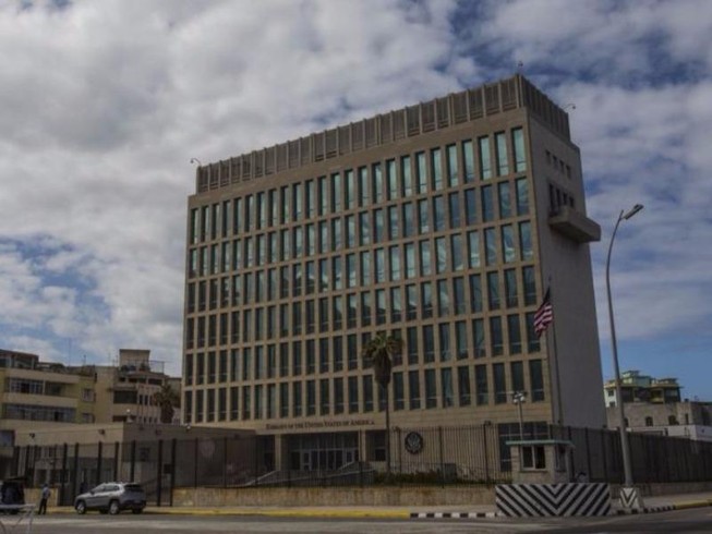 Các nhà ngoại giao Mỹ tại Cuba bị tổn thương não