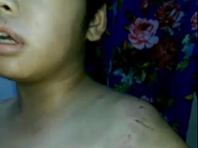 Bé 9 tuổi bị mẹ đánh nhập viện vì đọc kinh không thuộc