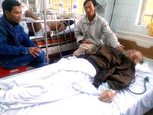Vừa mở cửa, chủ nhà bị đánh, chém tới tấp