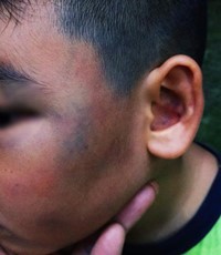 Tòa lại hoãn vụ tài xế xe ôm công nghệ đánh cháu bé ở quận 7