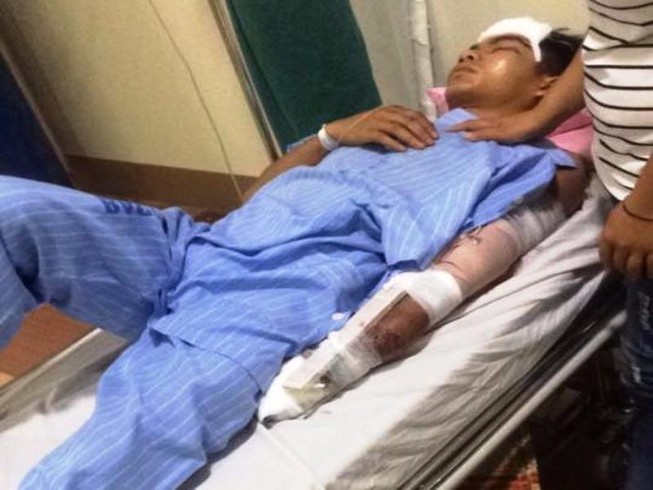 Truy tìm tài xế cán nát tay thanh niên rồi bỏ chạy
