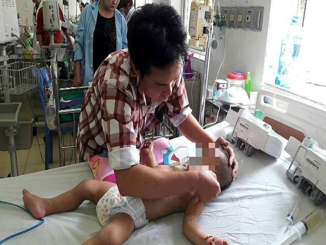 Đàn ong vây kín chích bé 19 tháng tuổi hàng trăm mũi