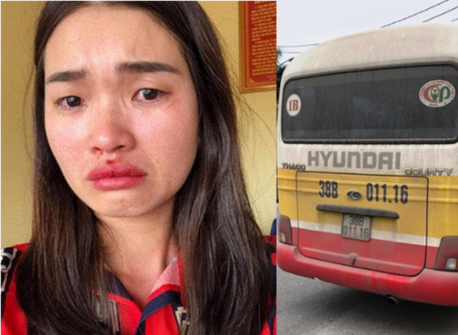 Khởi tố vợ chồng chủ xe 'dù' đánh nữ hành khách bên đường