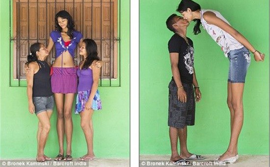 Chênh lệch giàu nghèo khiến chênh lệch chiều cao