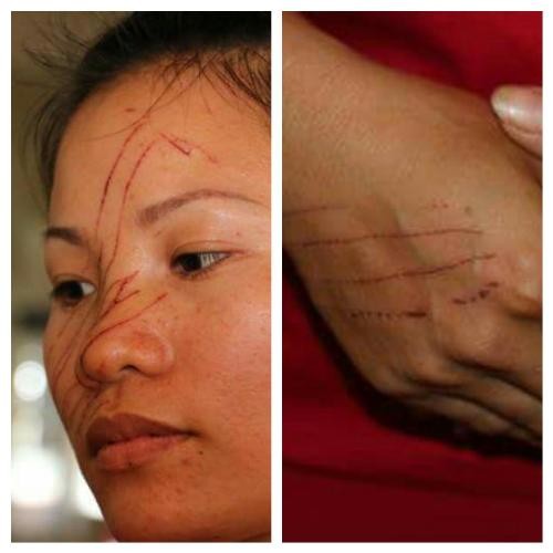 Hai mẹ con bị hàng xóm rạch mặt dã man