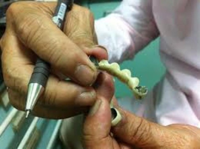 Sặc nước, trôi nguyên hàm răng giả vào cổ họng