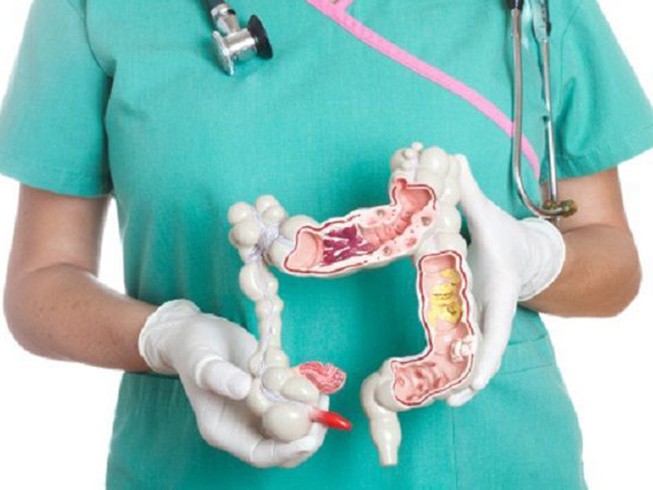 BV Thủ Đức điều trị thành công đa khối u ruột già