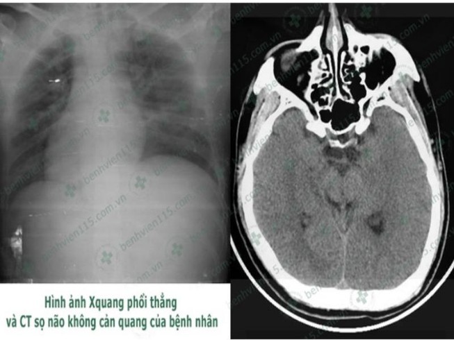 Tài xế hôn mê sâu khi lái xe chỉ vì quên ăn sáng
