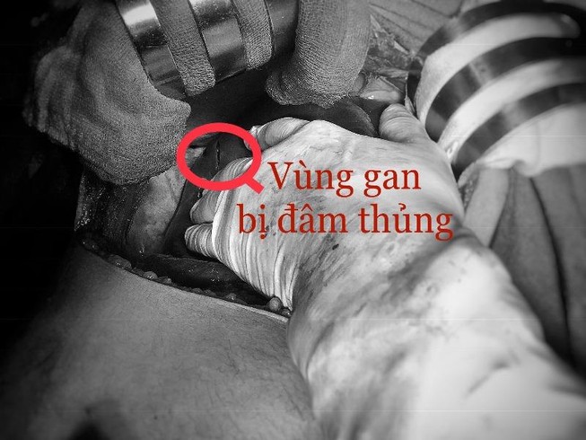 Bị đâm suýt chết vì tranh cãi bà Táo thương ông Táo nào nhất