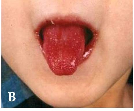 Gió độc từ Trung Quốc: Thủ phạm gây bệnh ở nhiều nước?