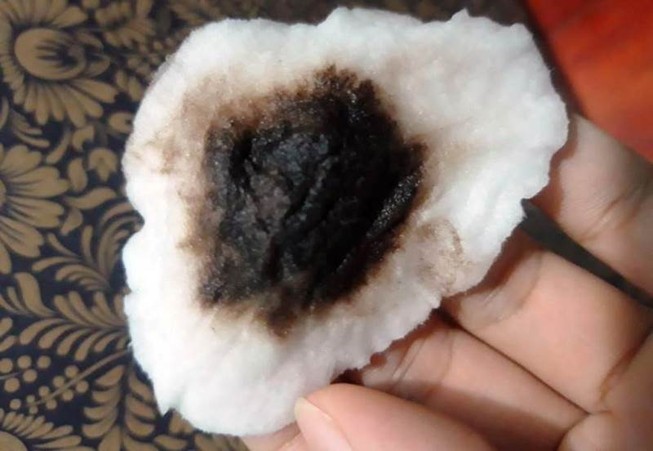 Sở Y tế vào cuộc vụ nước đục, có vị lợ ở Đà Nẵng