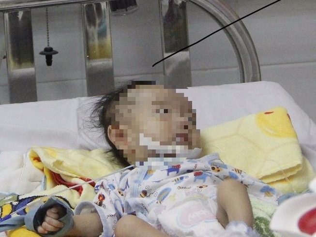 Bé mắc 3 dị tật lạ được cứu nhờ sức sống mãnh liệt