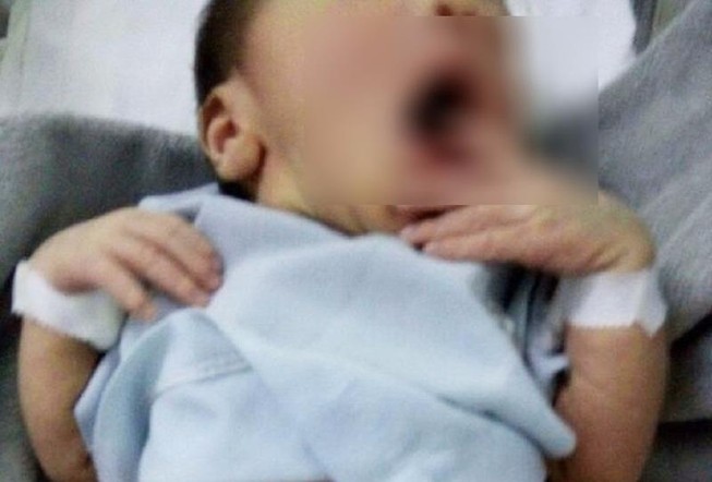 Bé mắc bệnh hiếm sinh ra không phân biệt được giới tính