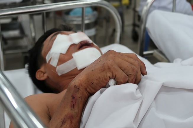 Lời kể của nạn nhân bị kẹp dính vào đầu xe sau tai nạn