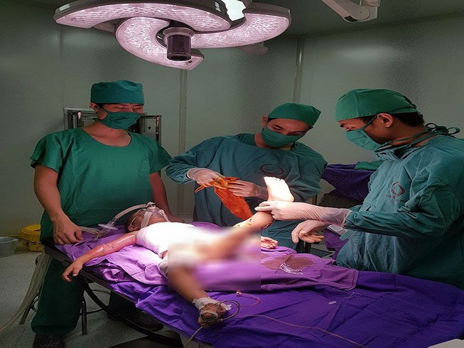 Bé 2 tuổi bị bỏng nước sôi tróc da toàn thân