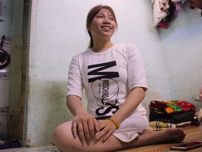 Sự thật về cô gái xinh đẹp mất một chân