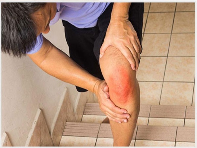 Cẩn trọng khi trị thoái hóa khớp bằng thuốc dân gian