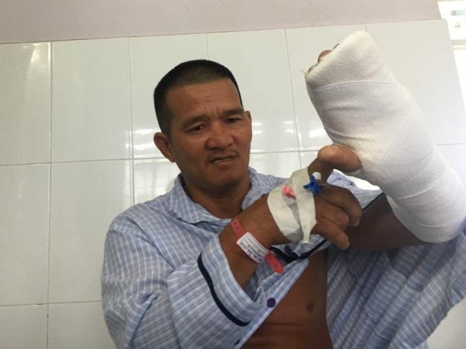 'Hiệp sĩ' Bình Dương bị thanh niên ngáo đá chém đứt gân tay
