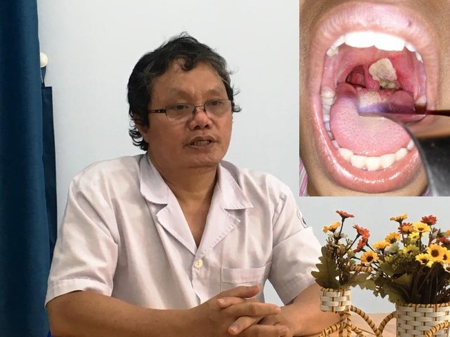 Bác sĩ Trương Hữu Khanh: Đừng cố tìm nguồn lây bạch hầu