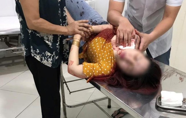 1 phụ nữ bị người quen tấn công bằng dao vào vùng cổ