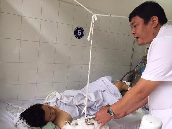 Đứt lìa cánh tay vì 2 xe khách tông nhau
