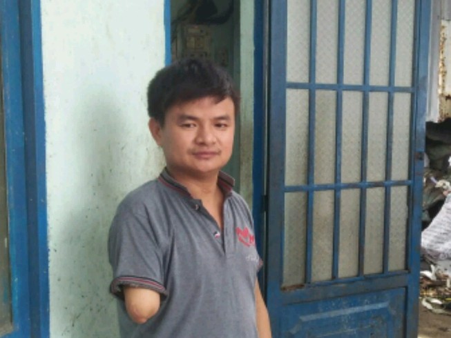 Bị mất một cánh tay đòi bồi thường bao nhiêu?