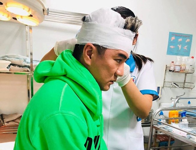 Họa sĩ Hoài Nam qua đời, Mr Đàm bị thương khi biểu diễn