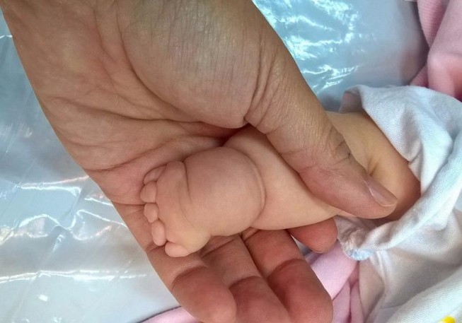 Tay chân bé có ngấn tưởng bụ bẫm, hóa ra bệnh lạ