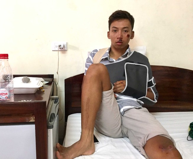 VĐV rời đường đua Cúp TH vì té gãy xương vai