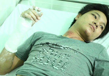Bị công an đánh gãy tay vì không đội mũ bảo hiểm?