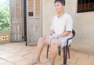 Đã mất bò lại còn bị nạn