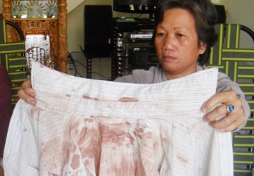 Không đội nón bảo hiểm, cả nhà bị đánh