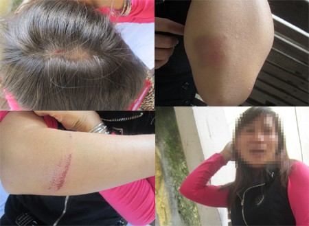 Trưởng công an xã bị tố đánh dân