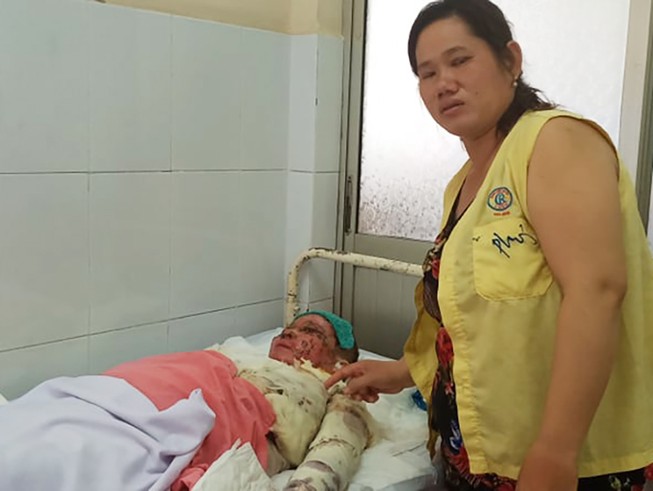 Người phụ nữ bị người tình tạt axit ở Bình Tân không qua khỏi
