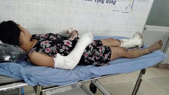 Thai phụ bị chồng đánh vỡ nền sọ, gãy tay bất ngờ trốn viện