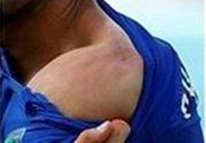 Khung hình phạt nào cho cú “cẩu xực” của Suarez?
